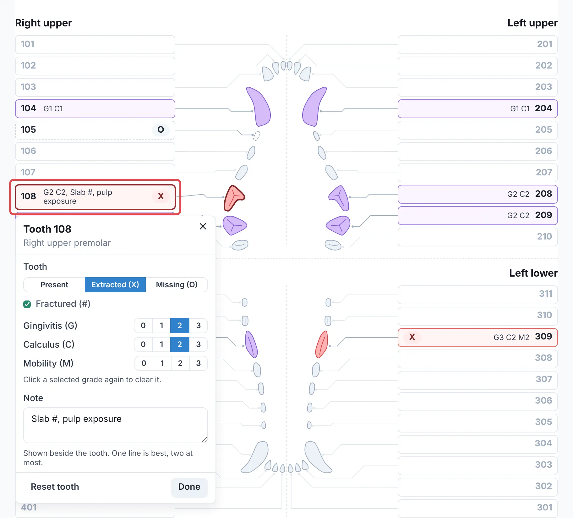The tooth editor open for tooth 108, with the tooth outlined in red